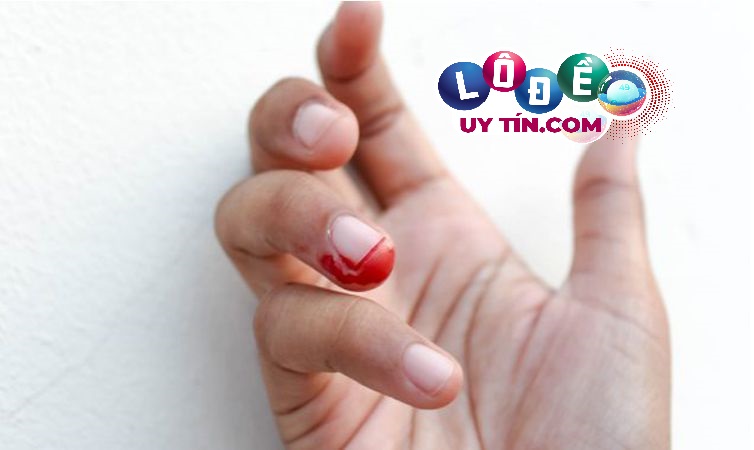 Phân tích ý nghĩa xung quanh giấc mơ thấy đứt tay chảy máu 1