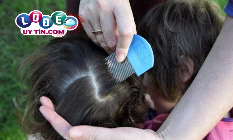 Giải mã giấc mơ: Nằm mơ thấy con chấy đánh con gì dễ ăn? 3 Nằm mơ thấy con chấy đánh con gì dễ ăn 2